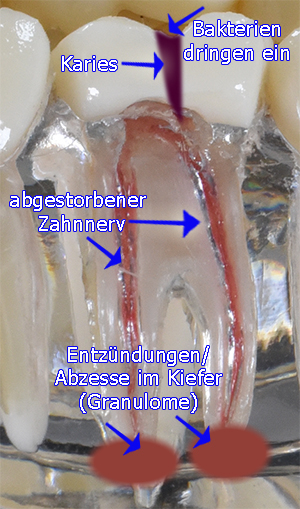 endodontologie3