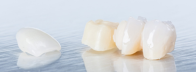 Zahnersatz und Implantate aus China